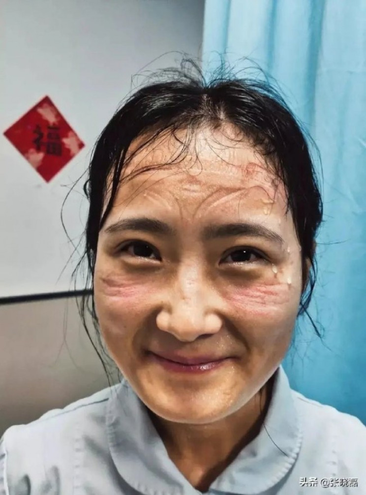 See The Faces Of Doctors Who Were Treating Coronavirus Affected Patients For Hours