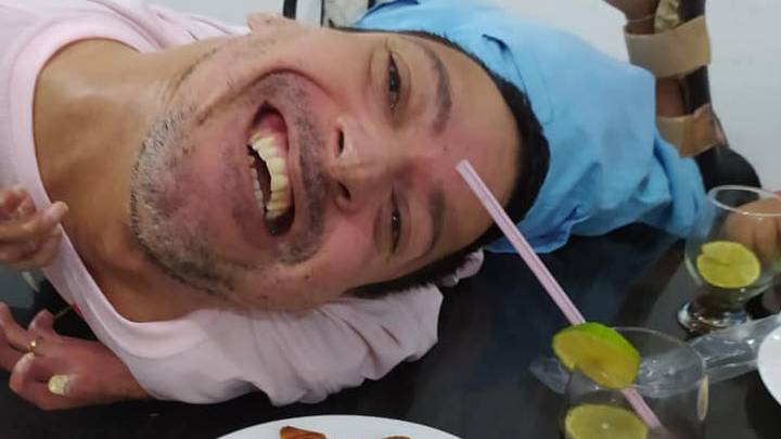 Brazilian man with his head "upside-down" wasn’t expected to live first 24 hours