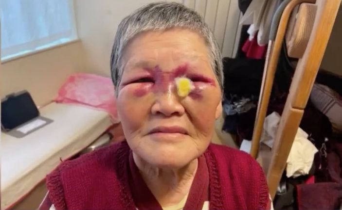 Asian Grandma Who Got Punched In The Face For Race, Donates All $900,000 Raised For Her