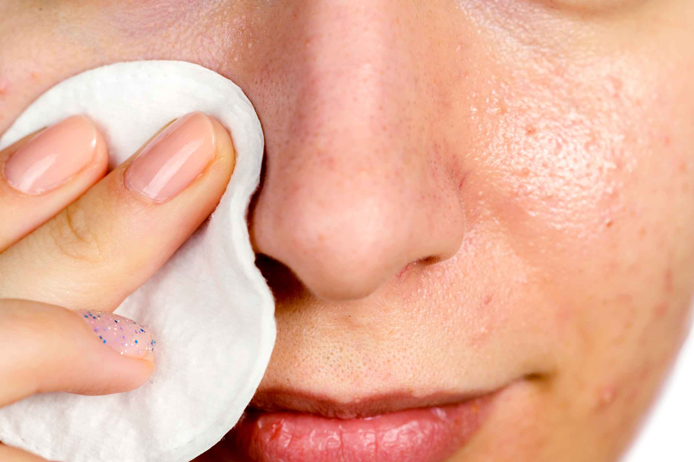 Easy Tricks To Remove Your Blackheads And For Getting A Glowing Skin