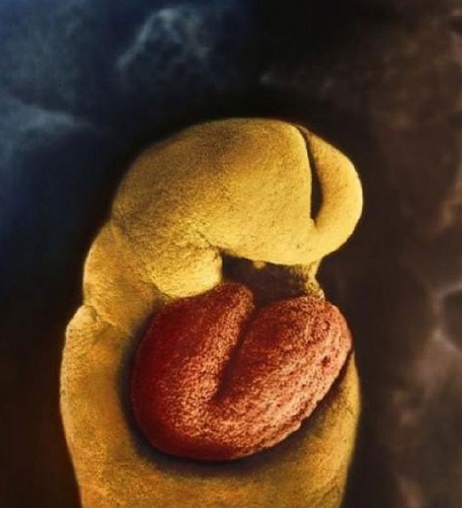 Photographs Showing Every Stage Of How A Child Is Born
