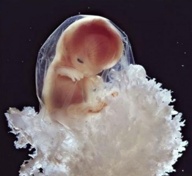 Photographs Showing Every Stage Of How A Child Is Born