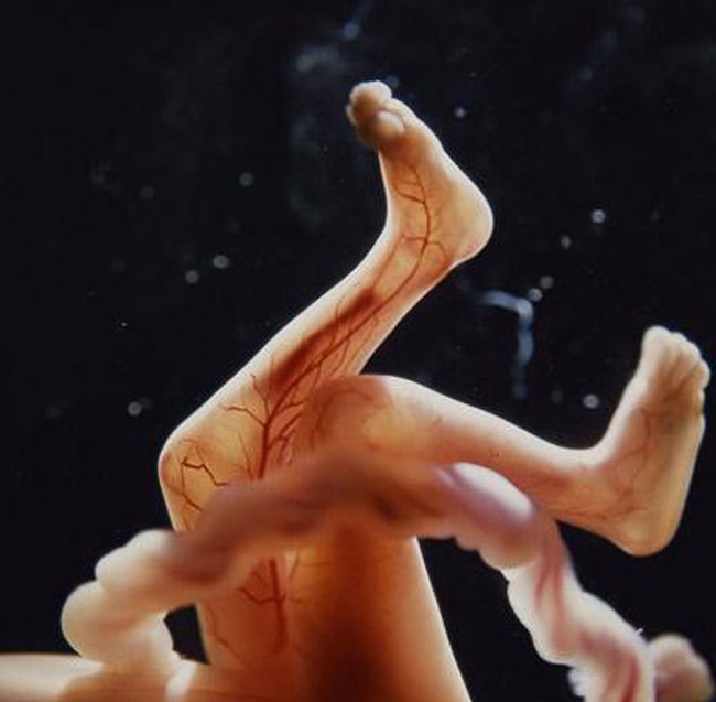 Photographs Showing Every Stage Of How A Child Is Born