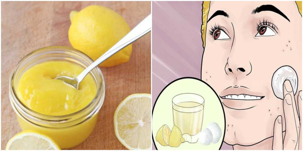 Easy Tricks To Remove Your Blackheads And For Getting A Glowing Skin