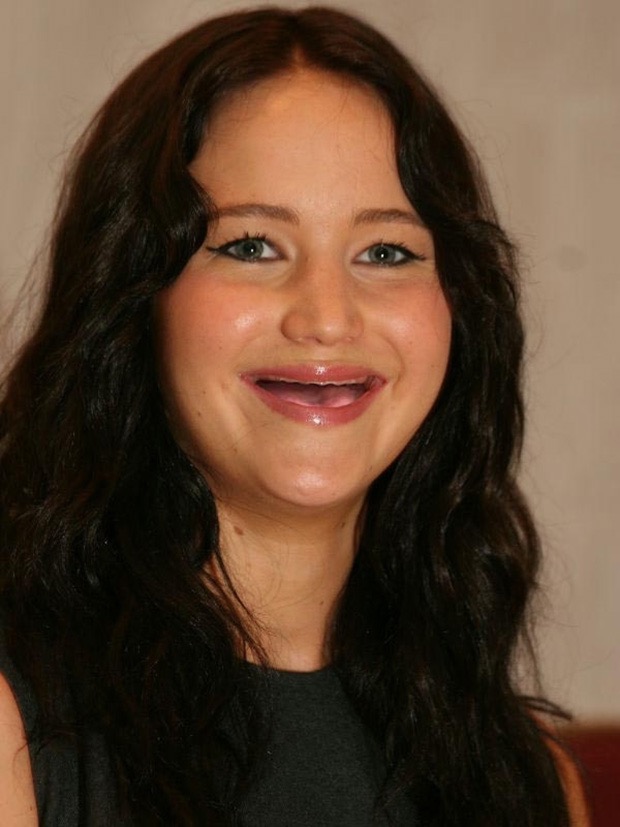 Your Favorite Celebrities Will Look Without Teeth