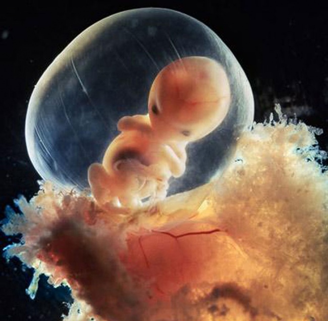 Photographs Showing Every Stage Of How A Child Is Born