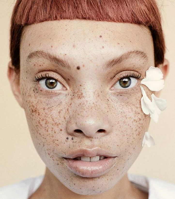 20 People Who Prove Everyone Is Beautiful In Their Own Way