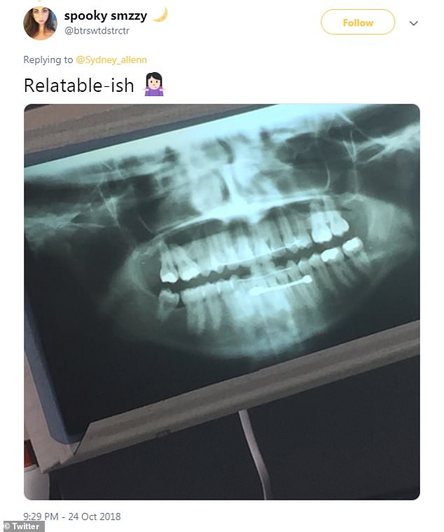 Mom Found Out About The Secret Piercing Of Her Young Daughter In A X-ray