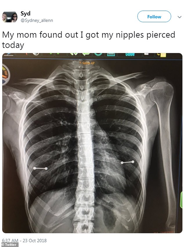 Mom Found Out About The Secret Piercing Of Her Young Daughter In A X-ray