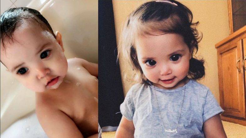 A Rare Genetic Condition Made This Little Girl's Eyes Look Big And Gorgeous