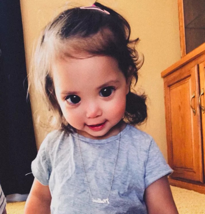 A Rare Genetic Condition Made This Little Girl's Eyes Look Big And Gorgeous