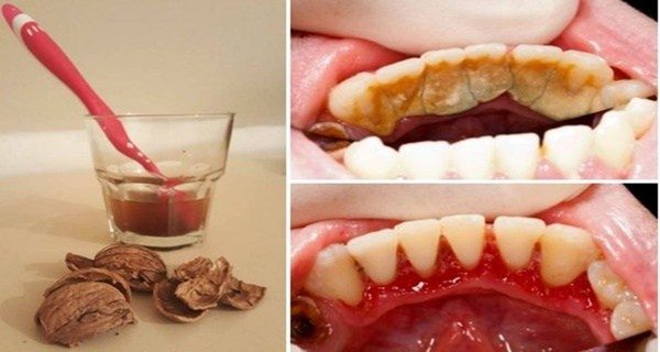 Mistakes That You Unknowingly Make On Daily Basis Regarding Your Oral Hygiene