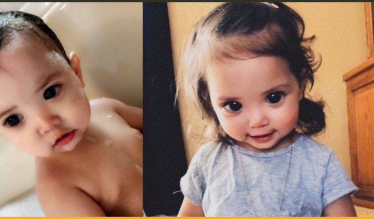 A Rare Genetic Condition Made This Little Girl’s Eyes Look Big And Gorgeous