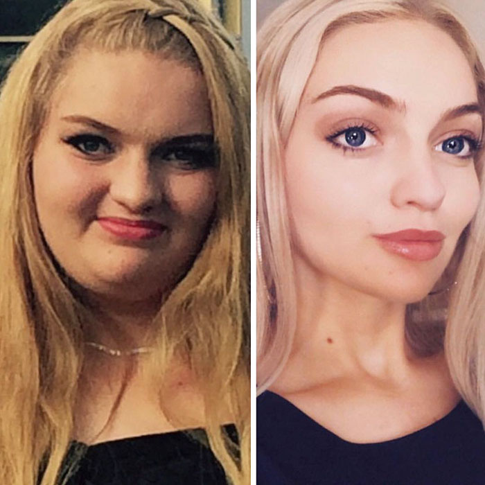 Australian Teen Ruling Instagram After Losing 198 Lbs