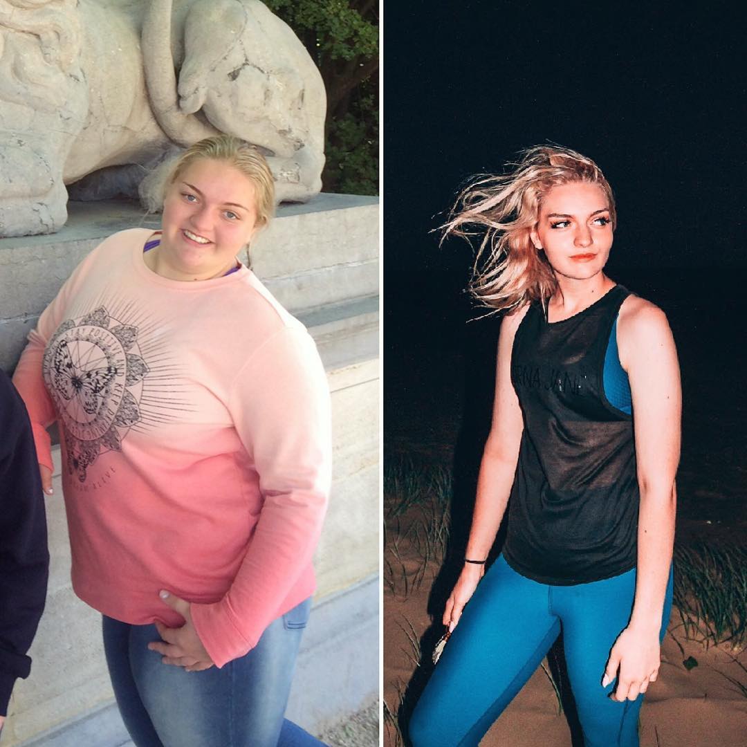 Australian Teen Ruling Instagram After Losing 198 Lbs