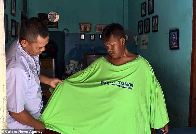 Inspiring Story Of An Unbelievable Transformation Of The Fattest Boy In The World