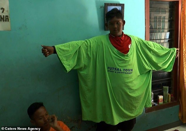 Inspiring Story Of An Unbelievable Transformation Of The Fattest Boy In The World