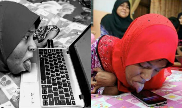 Disabled Girl Who Uses Her Smartphone and Laptop With Her Tongue