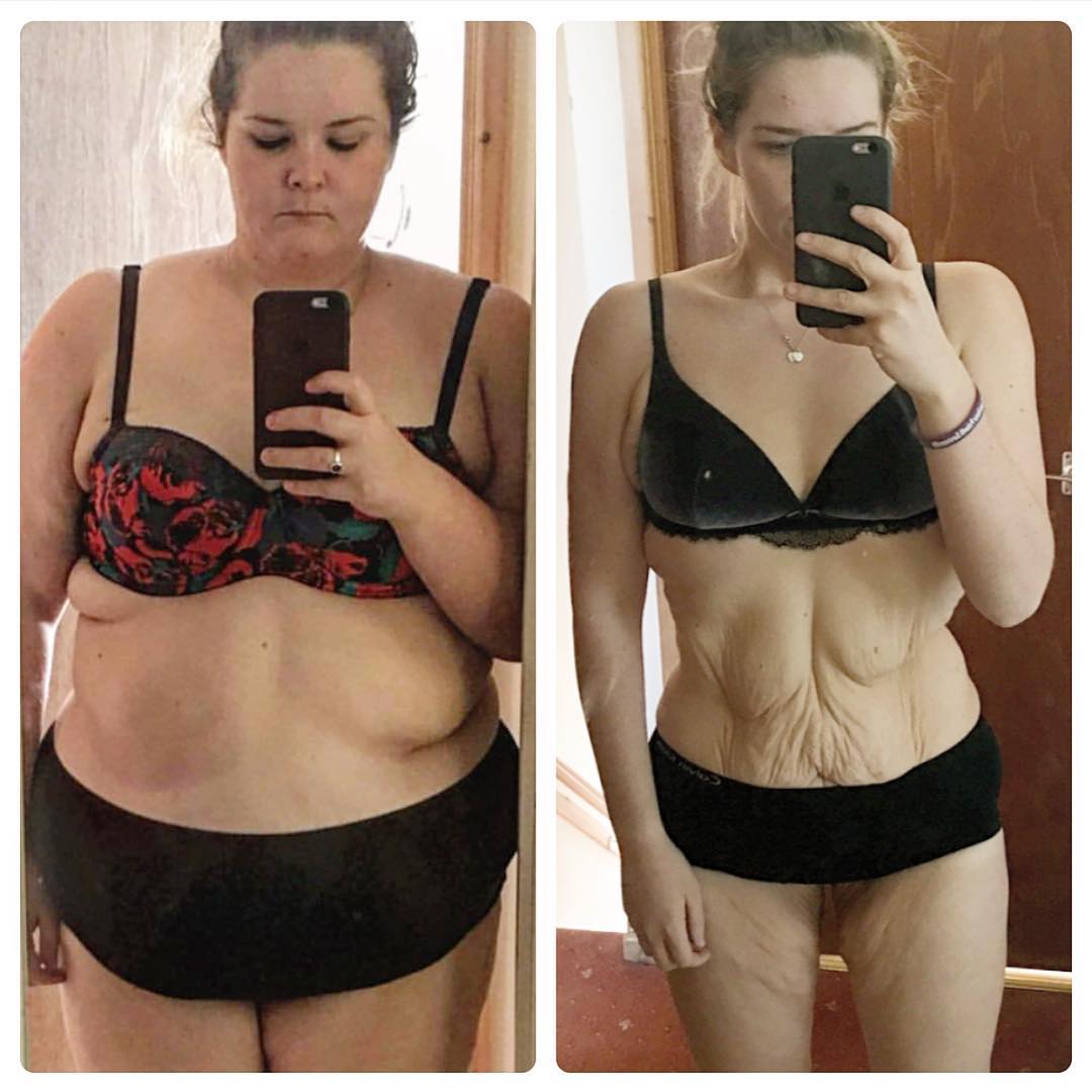 See The Amazing Body Transformation Of 24-Year-Old Girl Who Ate Non Stop For Two Years