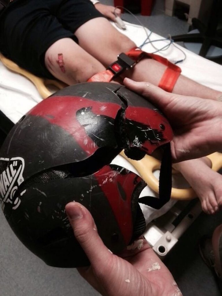 Here's Why You Should Always Wear A Helmet