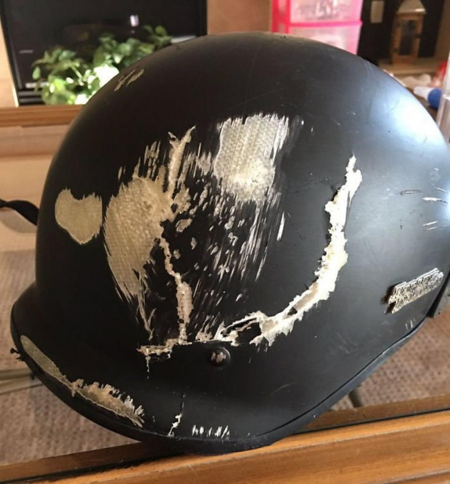 Here's Why You Should Always Wear A Helmet