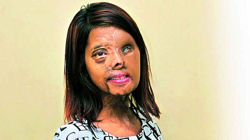 Acid Attack Survivor Is Now A Fashion Icon