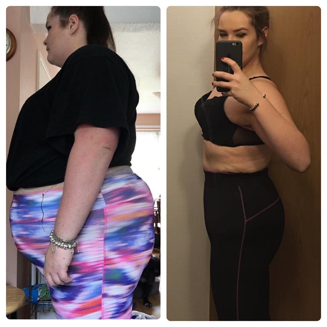 See The Amazing Body Transformation Of 24-Year-Old Girl Who Ate Non Stop For Two Years