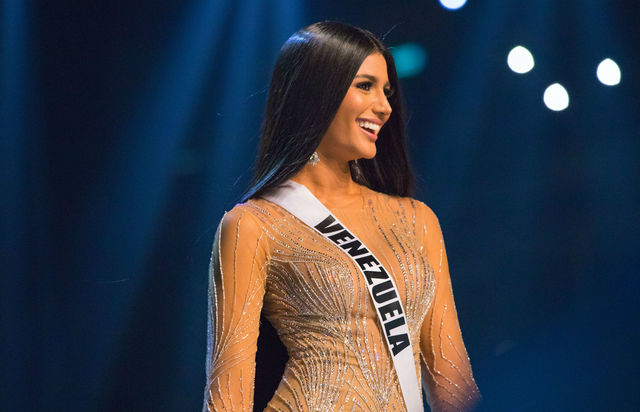 Before & After Surgery Photos Of Miss Venezuela Revealed By Her Surgeon