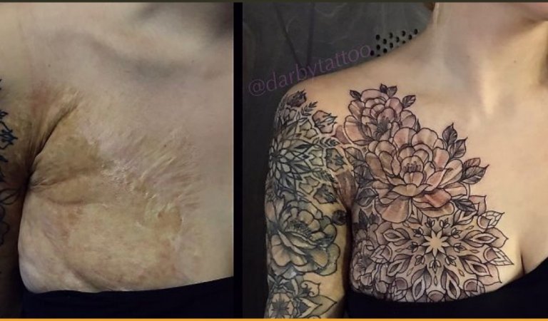 18 Times When Tattoo Artist Made Scars and Birthmarks Looks Beautiful