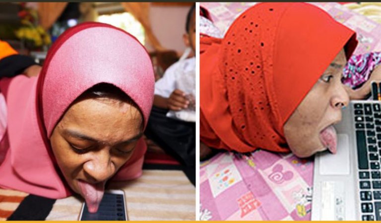This Disabled Girl Uses Her Smartphone and Laptop With Her Tongue!