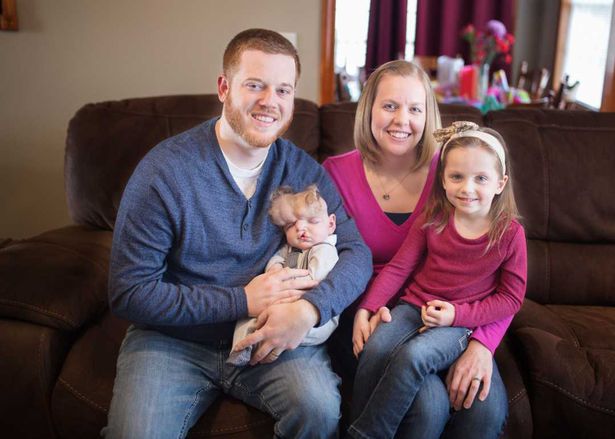 The Baby Who Took Birth Without A Skull Celebrates His First Birthday