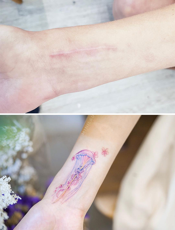 tattoo artist, scars and birthmarks