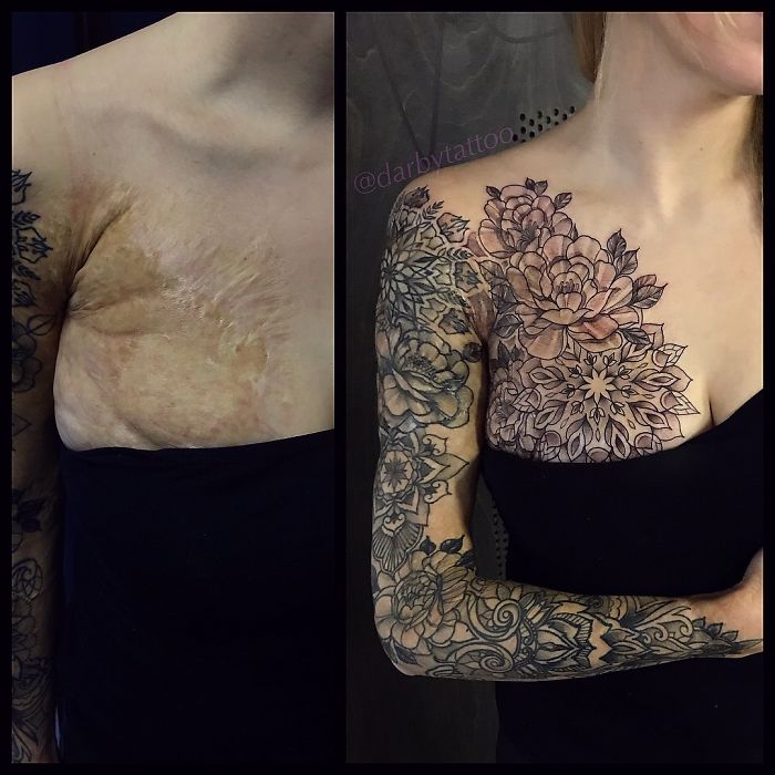 tattoo artist, scars and birthmarks