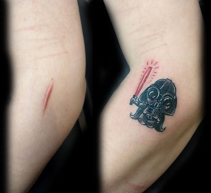 tattoo artist, scars and birthmarks