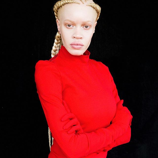 Meet The Albino African American Model Who Proves That Beauty Isn't Black And White