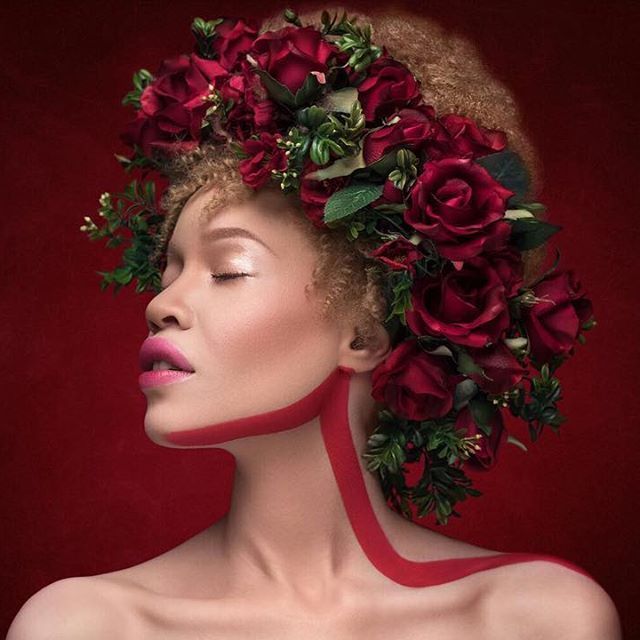 Meet The Albino African American Model Who Proves That Beauty Isn't Black And White