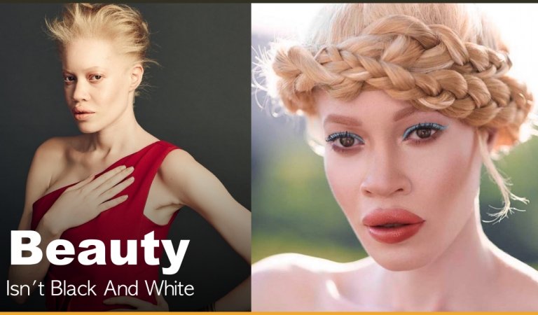 Meet The Albino African American Model Who Proves That Beauty Isn’t Black And White