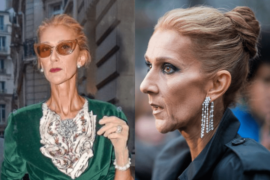 Celine Dion gets a drastic weight loss