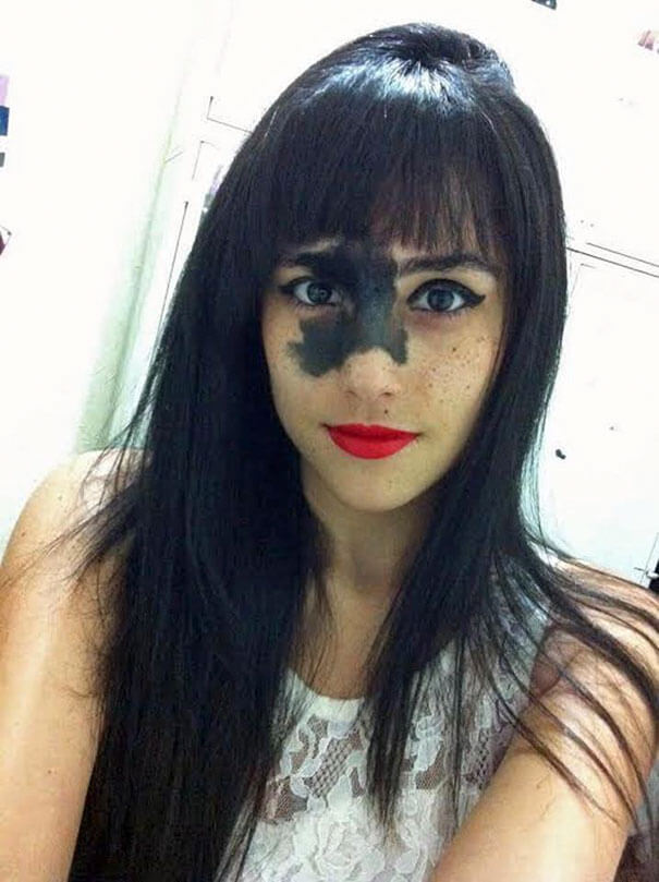 Brazilian Girl Decided Not To Remove Birthmark Even After She Faced Criticims