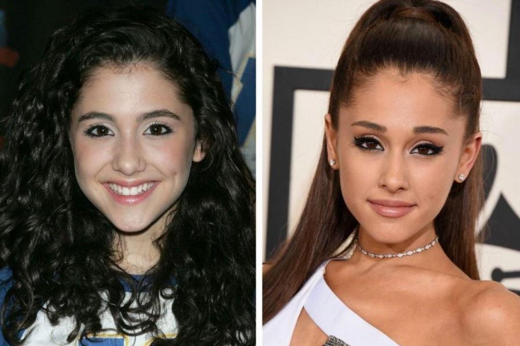 Unbelievable Transformation Of Some Hollywood Celebs Through The Years