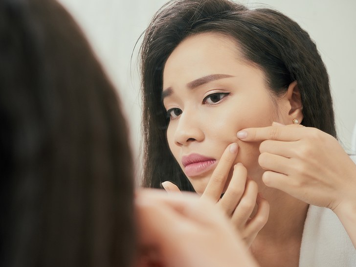 Here's Why You Need To Stop Popping Your Pimples Right Away