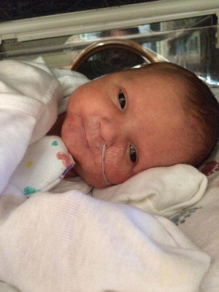 Smiling Photos Of Premature Babies