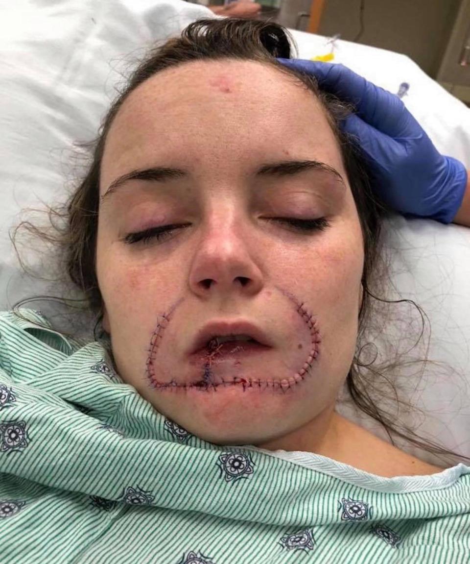 This girl's Ex Boyfriend Tore Her Lips Off Because He Wanted To Leave His Mark On Her For Her Next Boyfriend