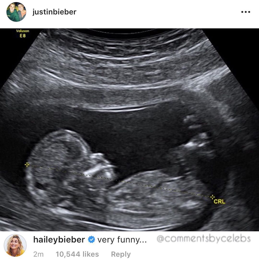 Justin Bieber Reveals The Pictures He Shared To Show Hailey Baldwin Is Pregnant Was An April Fool's Joke