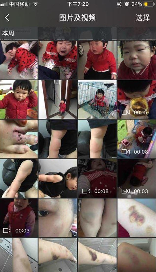 Chinese Father Brutally Tortures His 20-Month-Old Daughter To Get Revenge From Ex-Wife
