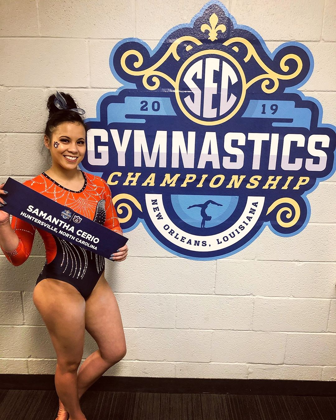 Gymnast Broke Both Her Legs After A Horrific Accident During Her Routine