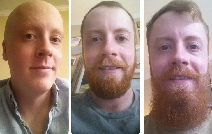 These Pictures Prove That Growing A Beard Can Change Everything