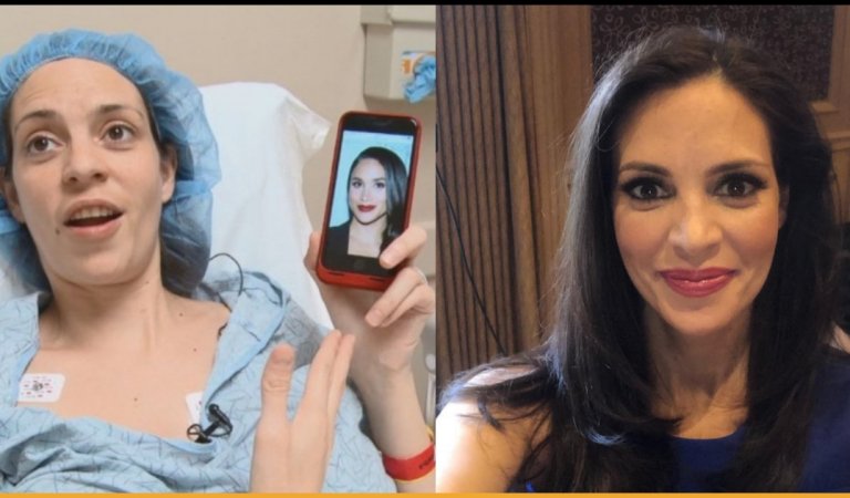 Mother Goes Through Multiple Painful Surgeries To Look Like Meghan Markle But Looks Nothing Like Her