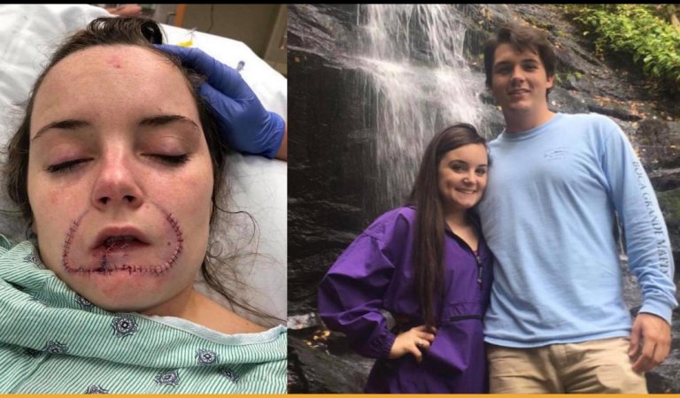 Ex-Boyfriend Bite Off Girl’s Lip Because He Wanted To ‘Leave A Mark’ For Her Next Boyfriend