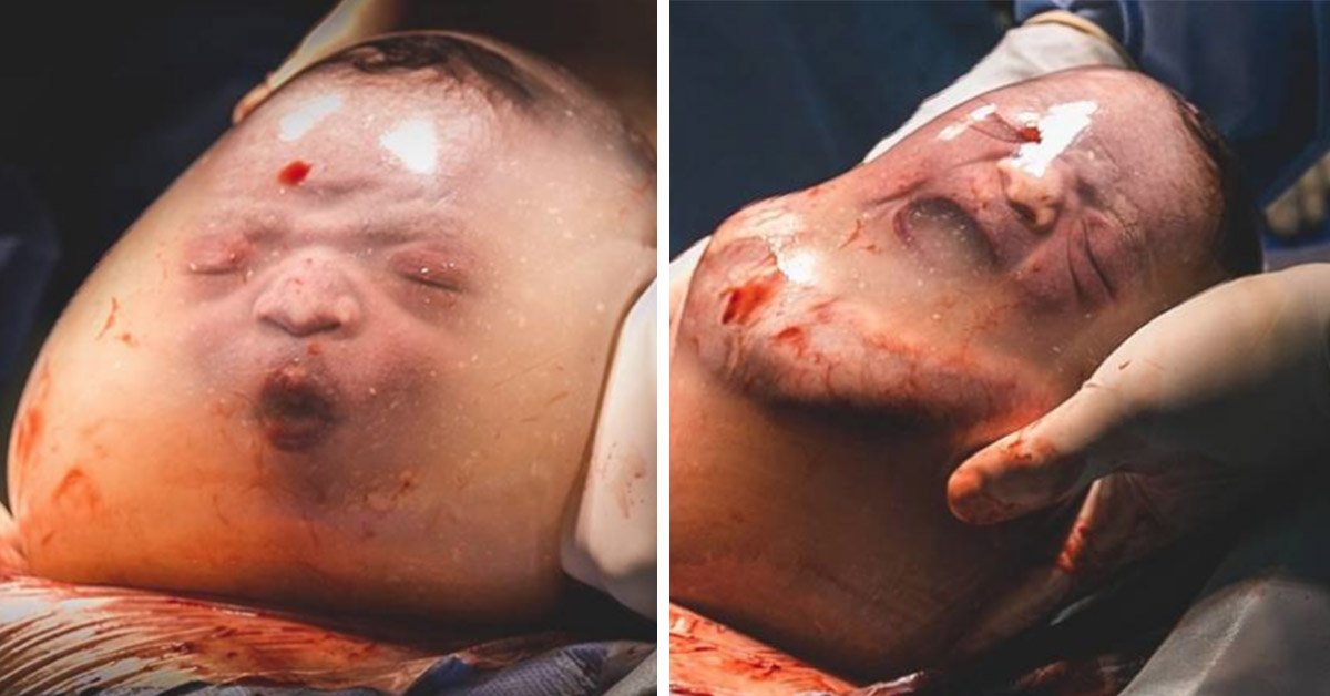 Adorable Baby Boy Born En Caul, Inside A Bubble Captured Into Amazing Photographs